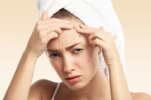 young woman with towel head have acne